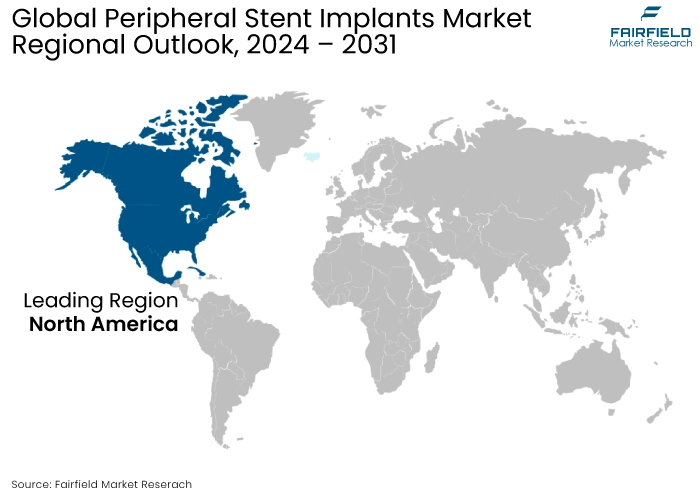 Peripheral Stent Implants Market, Regional Outlook, 2024 - 2031