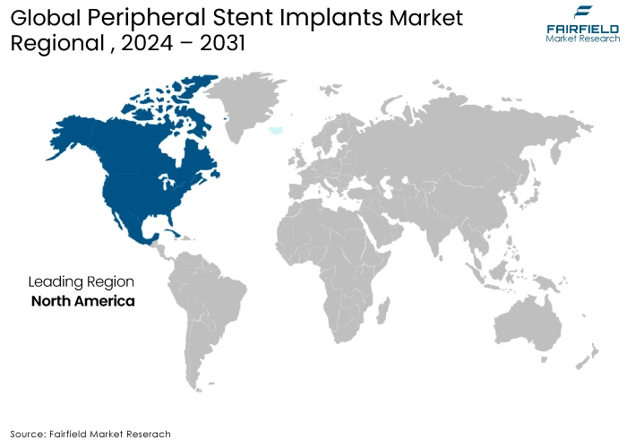 Peripheral Stent Implants Market Regional Outlook, 2024 - 2031